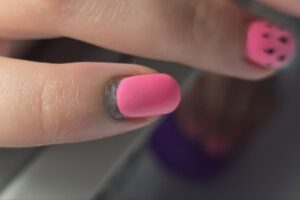 1_травма ногтя