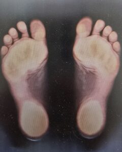 1диагностика