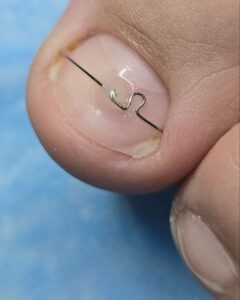 1коррсистема