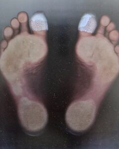 2диагностика