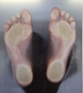 4диагностика