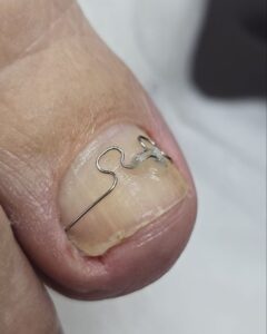 коррекционная система