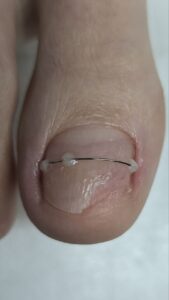 коррсистема