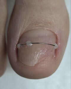 коррсистема