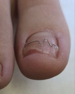 корсистема