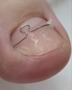 корсистемы