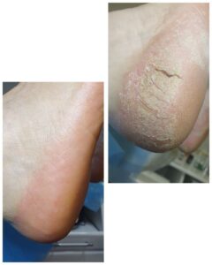 обробка тріщин