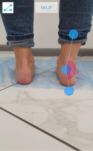 осмотр стоп