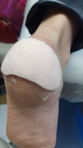 разгрузка на пятке