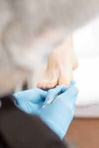 подологический педикюр