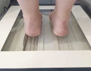 диагностика стоп