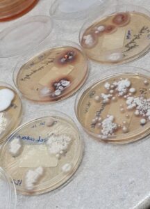 Лабораторный анализ на грибок