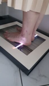 диагностика стопы на платноскопе