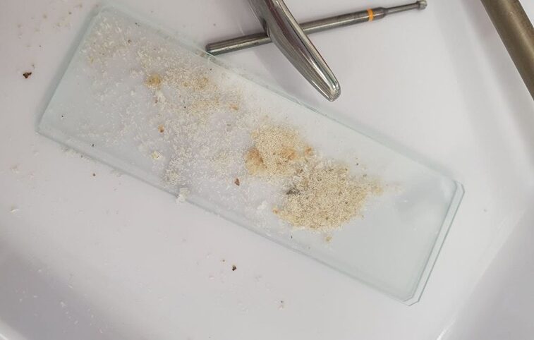 podgotovlennыj-podologom-materyal-dlya-analyza-na-grybok-edited